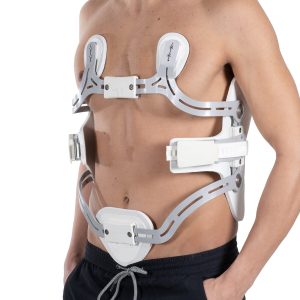 Hiperextension Corset 4 Points - back corset supplied by SINEM Afrique Medical Cameroon