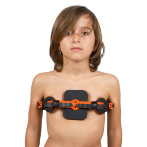 Pectus Carinatum Orthosis Dynamic - pediatric orthopedic support supplied by SINEM Afrique Medical Cameroon
