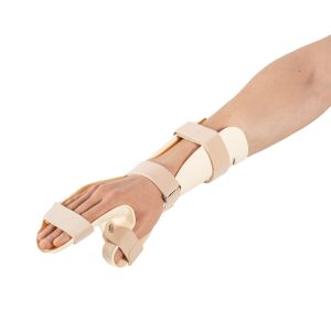 Thermoplastic Wrist Splint - wrist brace supplied by SINEM Afrique Medical Cameroon