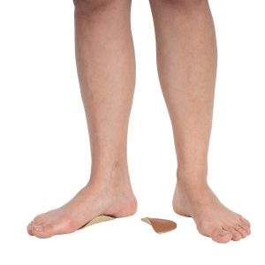 Rubber Arch Support - arch support supplied by SINEM Afrique Medical Cameroon